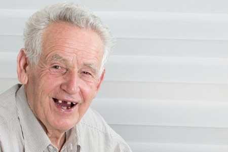 بیش از نیمی از سالمندان ایرانی فاقد دندان هستند